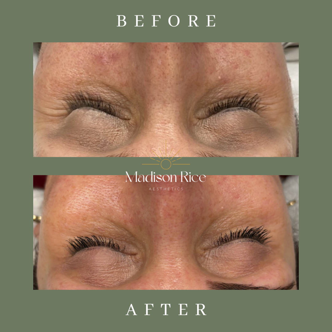 Eyeliner Tattoo result by Madison Rice Aesthetics in Statesboro, GA