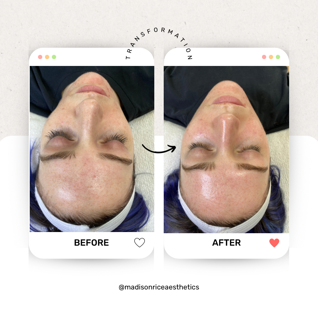 Permanent makeup work by Madison Rice Aesthetics in Statesboro, GA
