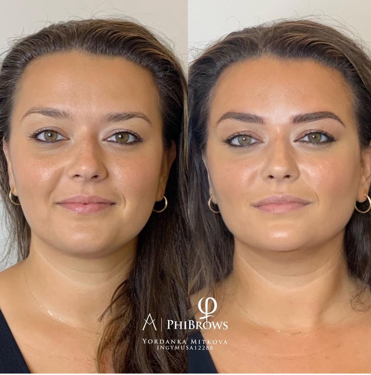 Eyebrow Tattoo result by PhiBrows By Dani in Roswell, GA