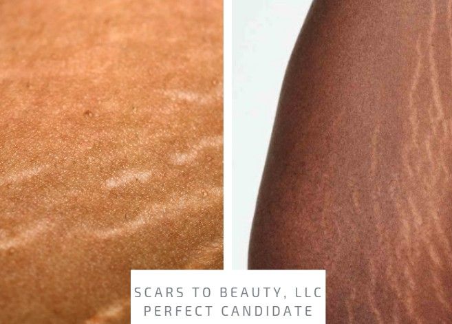 Permanent makeup work by Scars to Beauty LLC in Stockbridge, GA
