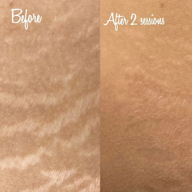 Permanent makeup work by Scars to Beauty LLC in Stockbridge, GA