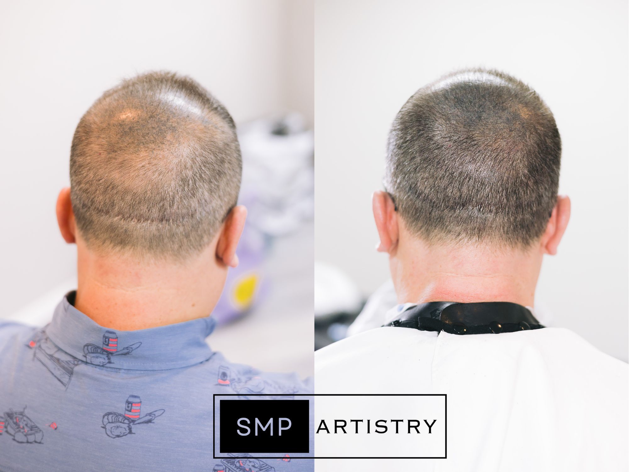 Permanent makeup work by SMP ARTISTRY ATL in Norcross, GA