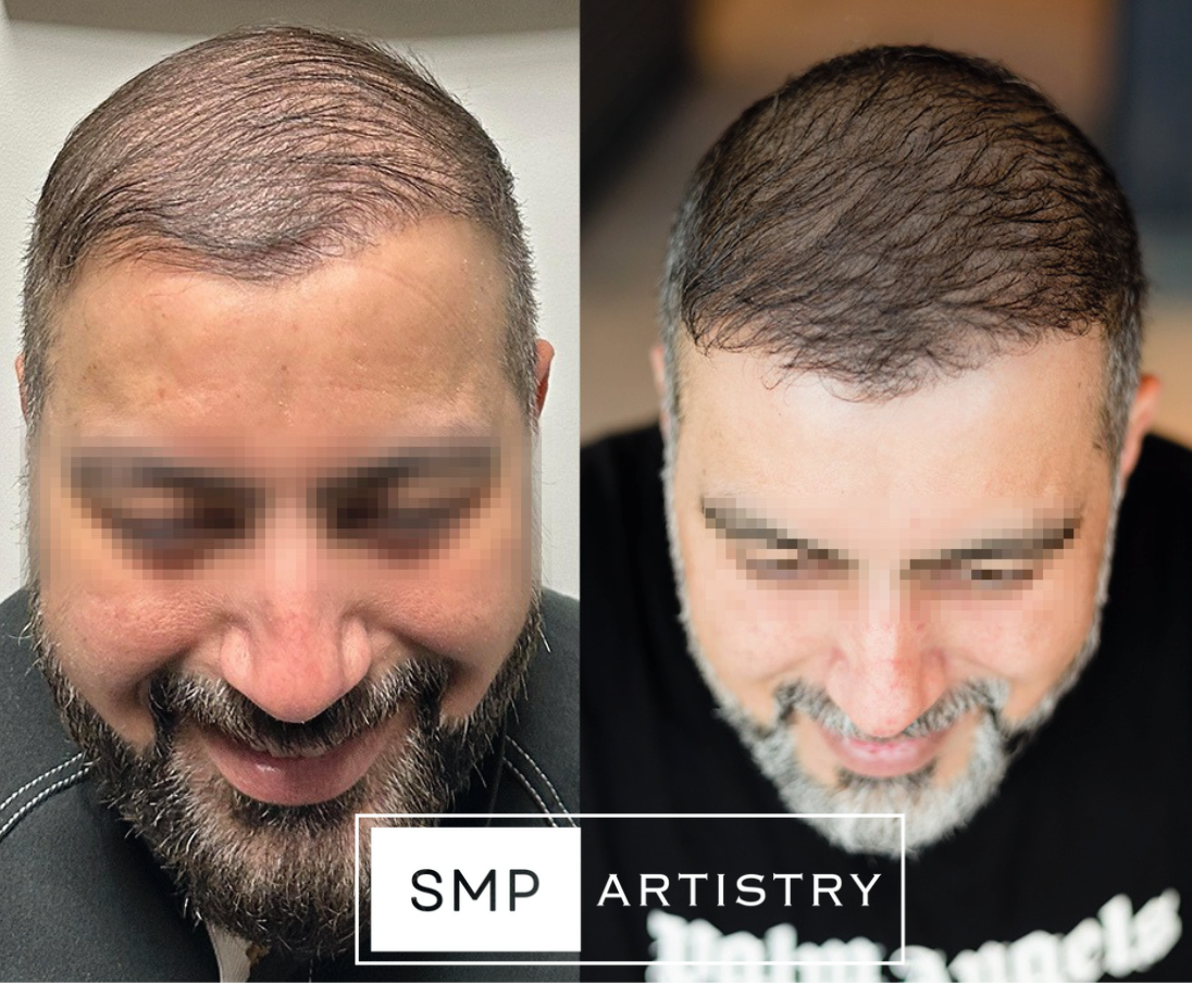 Permanent makeup work by SMP ARTISTRY ATL in Norcross, GA