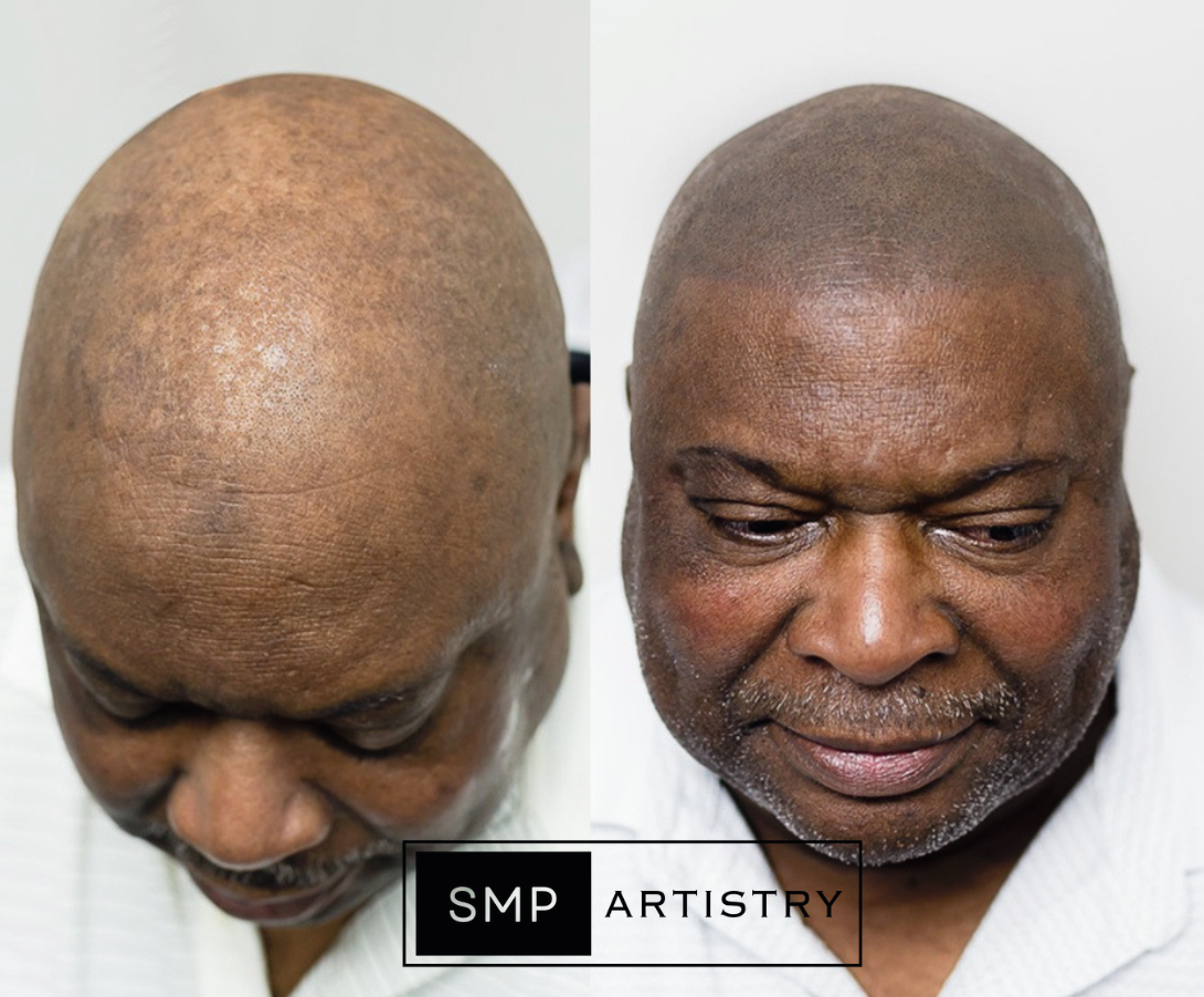 Permanent makeup work by SMP ARTISTRY ATL in Norcross, GA