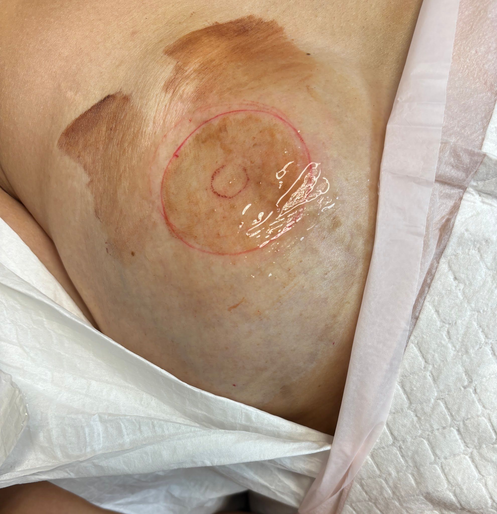 Areola Tattoo result by Brows by Tabi in Greensboro, GA