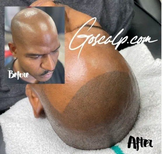Goscalp Scalp Micropigmentation Hair Loss Center — permanent makeup work