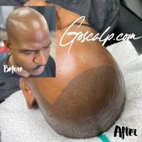 Goscalp Scalp Micropigmentation Hair Loss Center — permanent makeup work