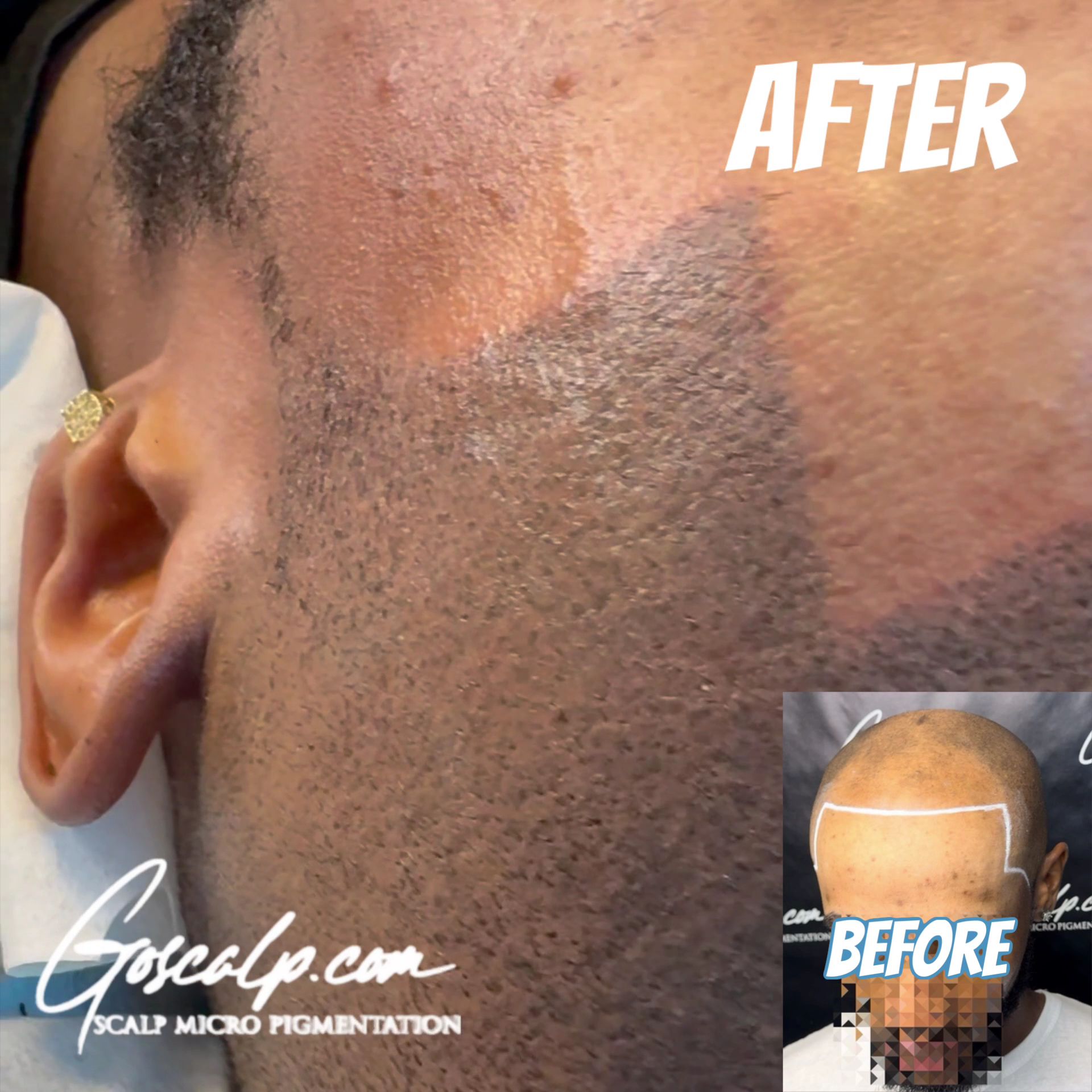Permanent makeup work by Goscalp Scalp Micropigmentation Hair Loss Center in Stonecrest, GA