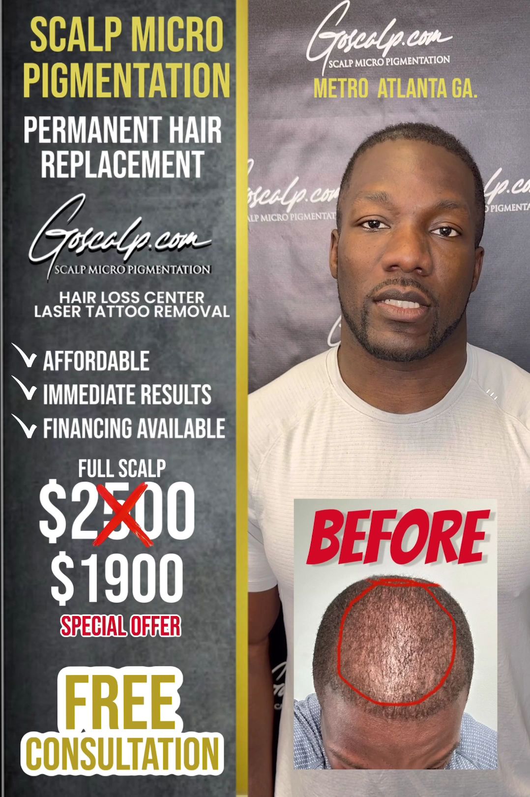 Permanent makeup work by Goscalp Scalp Micropigmentation Hair Loss Center in Stonecrest, GA
