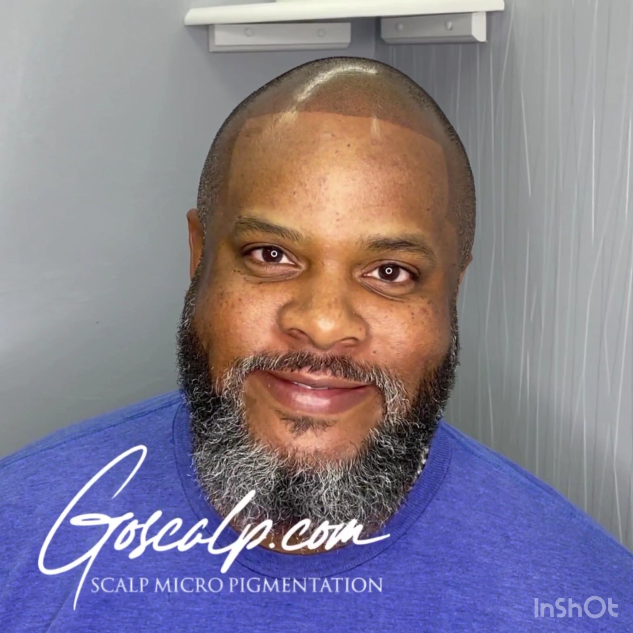 Permanent makeup work by Goscalp Scalp Micropigmentation Hair Loss Center in Stonecrest, GA