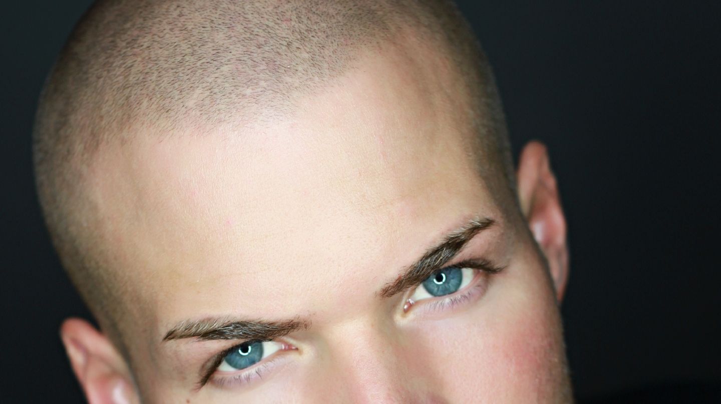 Eyebrow Tattoo result by Phoenix Hair Restoration & Aesthetics in Duluth, GA