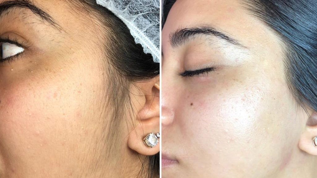 Permanent makeup work by Adara Aion Permanent Cosmetic Clinic in Winder, GA
