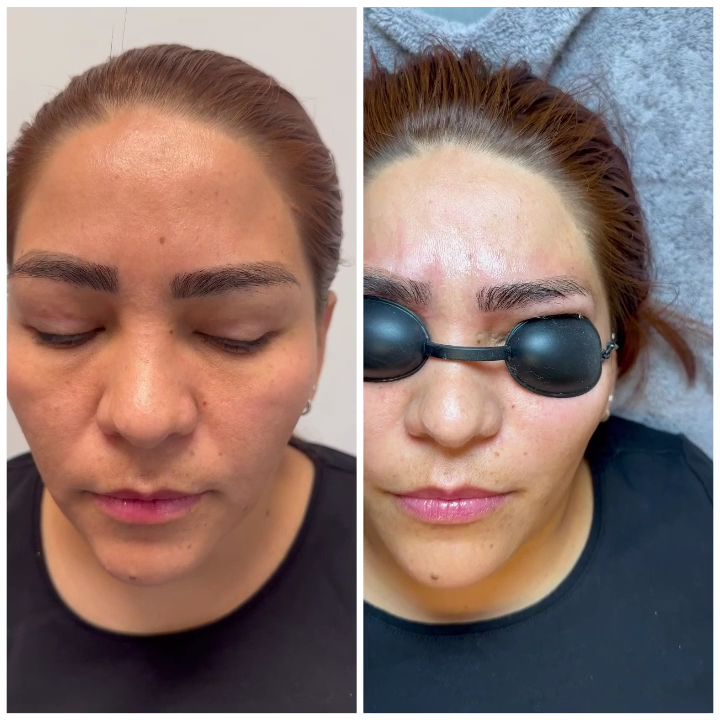 Eyebrow Tattoo result by Snown Microblading & Beauty Salon in Tucker, GA