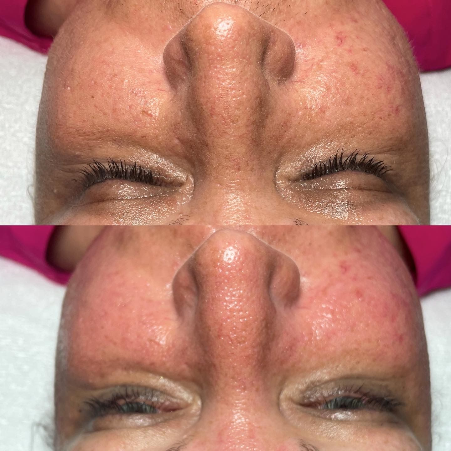 Eyeliner Tattoo result by HD Esthetics in Tifton, GA