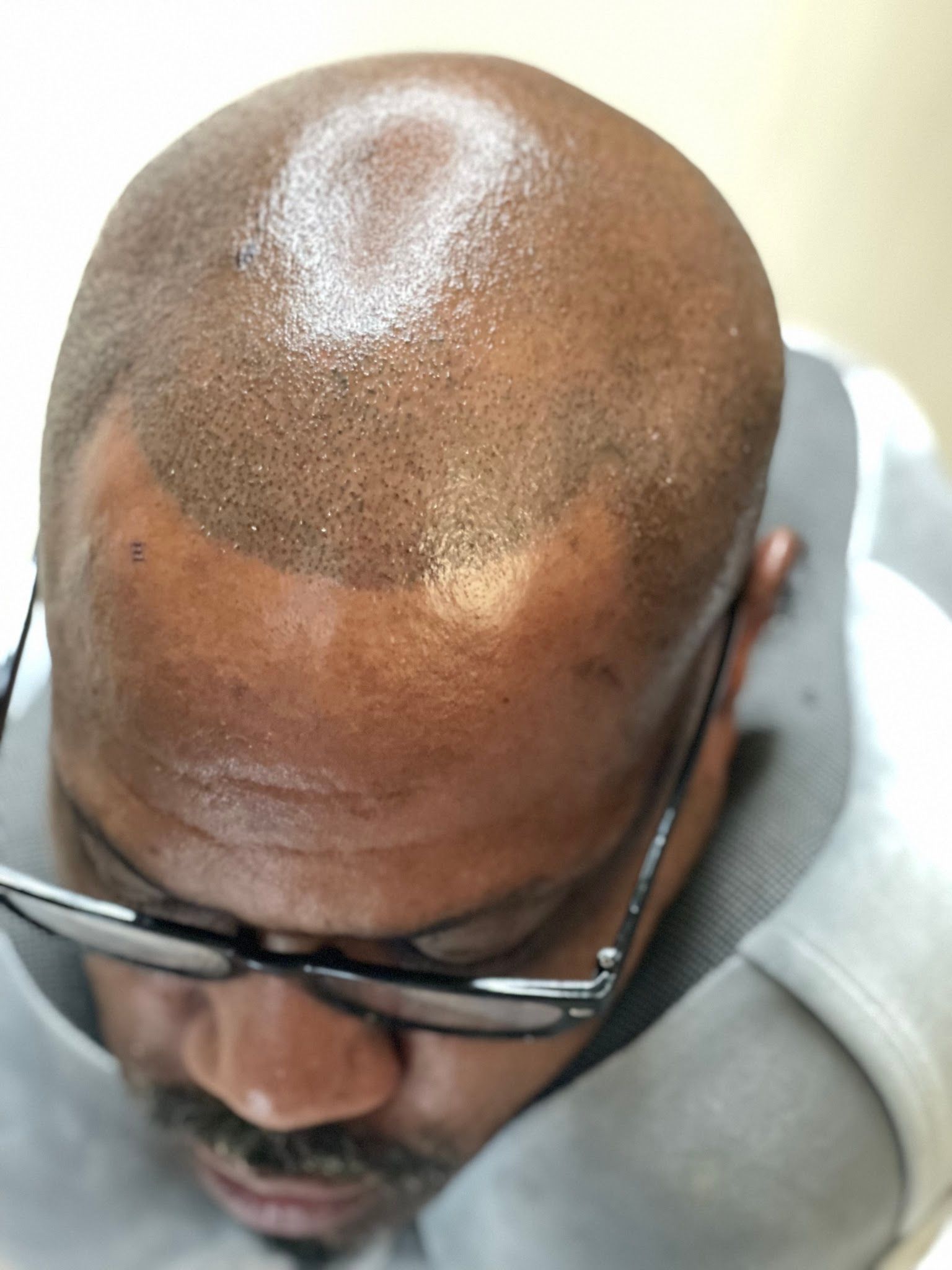 Burst Into Beauty — permanent makeup in Union City, GA