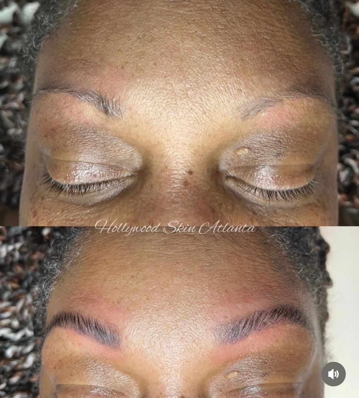 Eyebrow Tattoo result by Hollywood Skin Atlanta Sugar Hill in Sugar Hill, GA