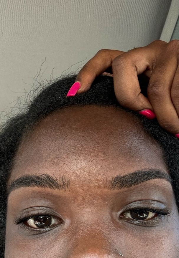 Eyebrow Tattoo result by The Arches Threading and Waxing @ Arbor Place Mall in Douglasville, GA