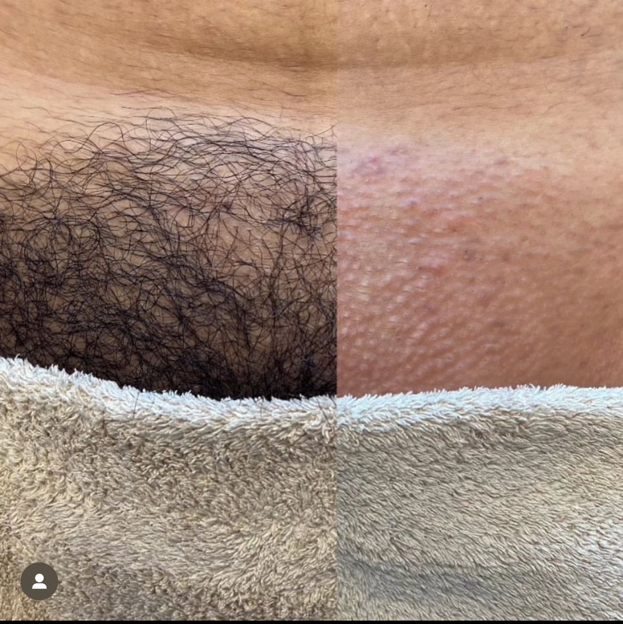 Areola Tattoo result by KR Beauty Bar LLC in Tifton, GA