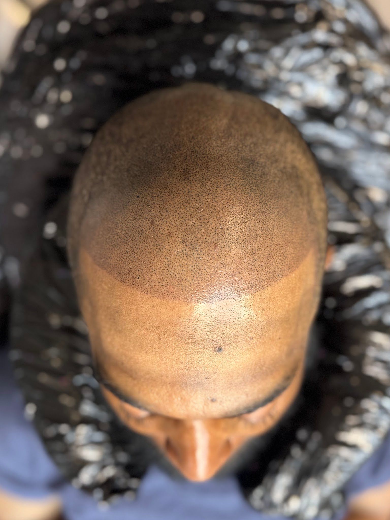 Permanent makeup work by Scalp Micropigmentation By Steven Bradley in Grovetown, GA