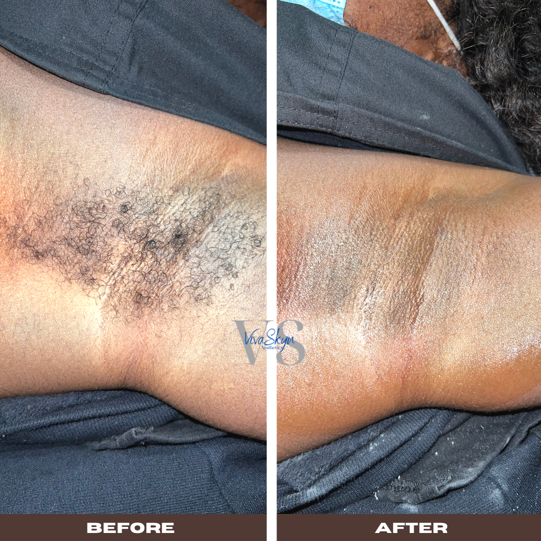 Permanent makeup work by VivaSkyn Aesthetics in Snellville, GA