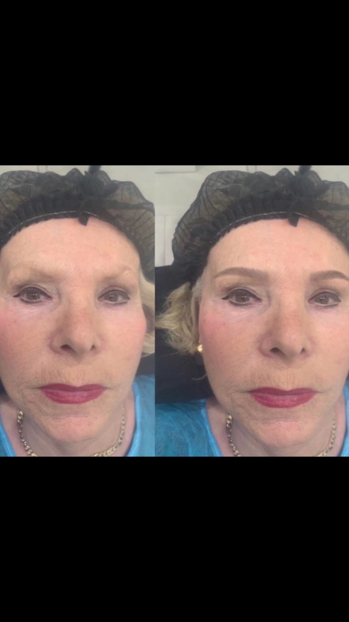Eyebrow Tattoo result by Nas Permanent Makeup and Training Center in Newport Beach, CA