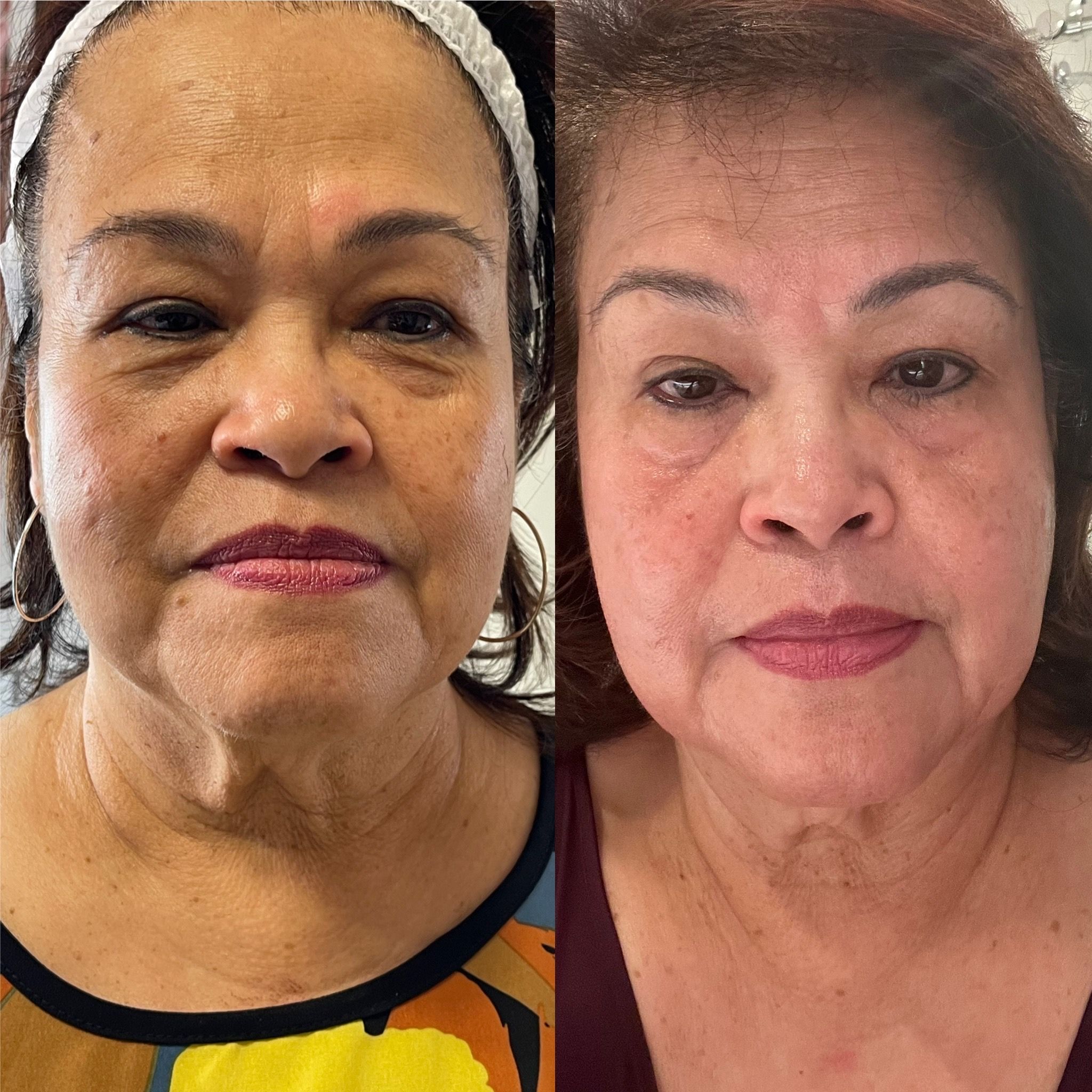 Eyebrow Tattoo result by Madison Beauty Care in Milledgeville, GA
