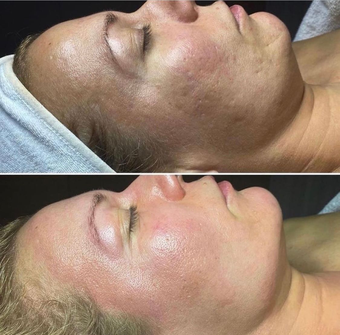 Eyeliner Tattoo result by Plum Artistry & Esthetics in Peachtree Corners, GA