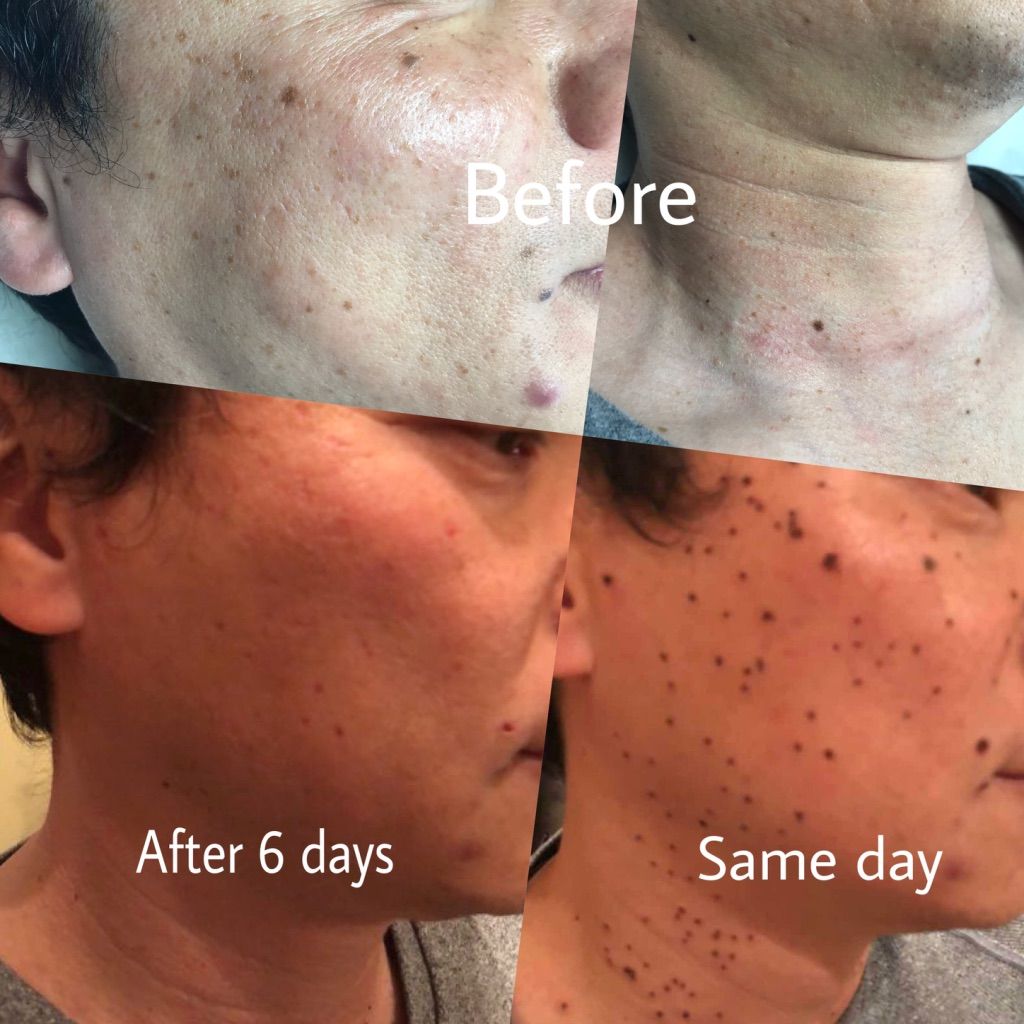 Permanent makeup work by VICKY SKIN CARE in Sugar Hill, GA