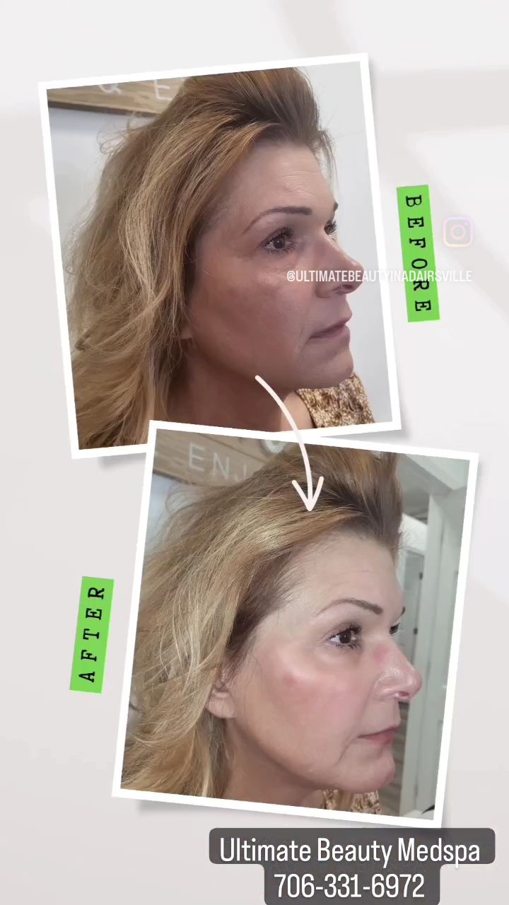 Eyebrow Tattoo result by Ultimate Beauty Medspa in Adairsville, GA