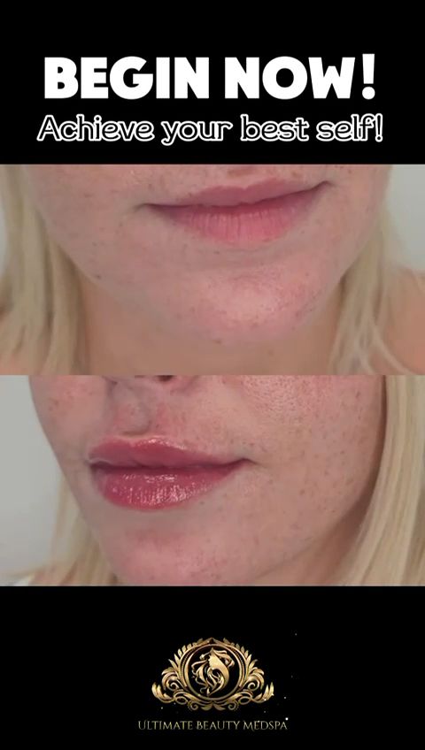 Permanent makeup work by Ultimate Beauty Medspa in Adairsville, GA