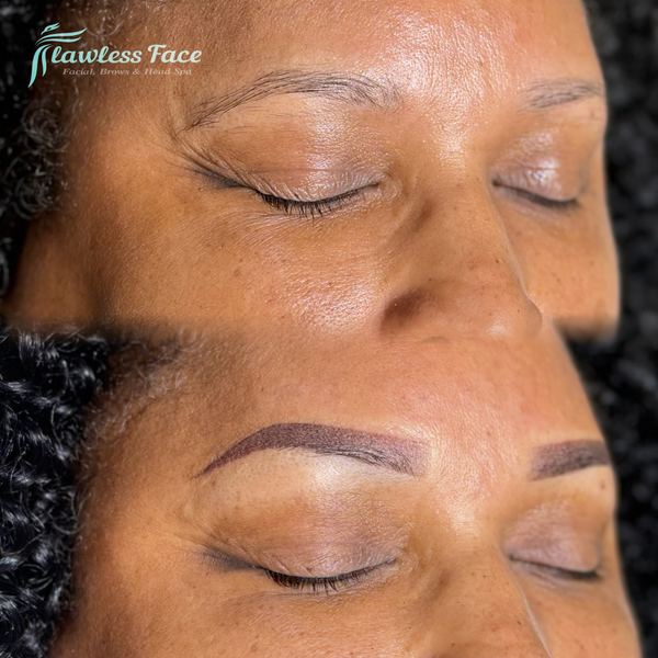 Flawless Face — saline tattoo removal in Evans, GA