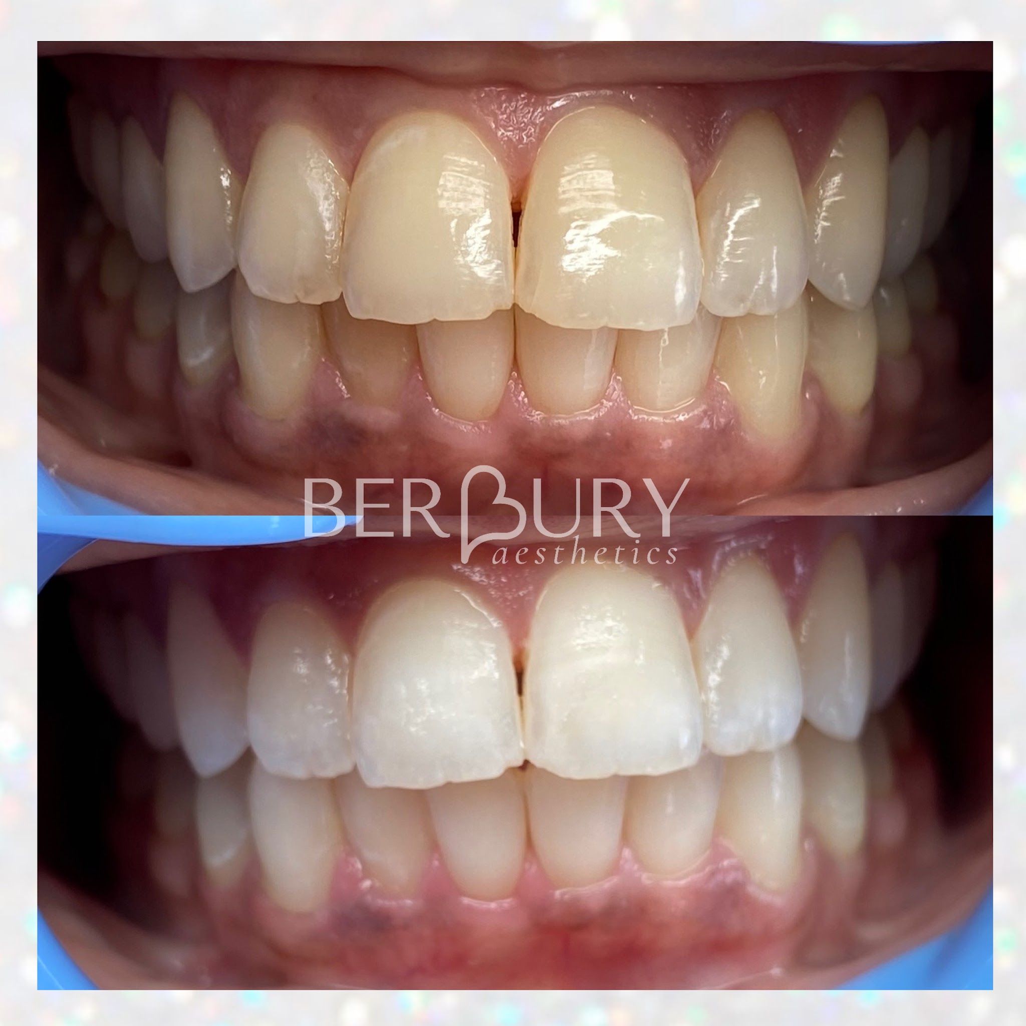 Permanent makeup work by Berbury Aesthetics in Savannah, GA