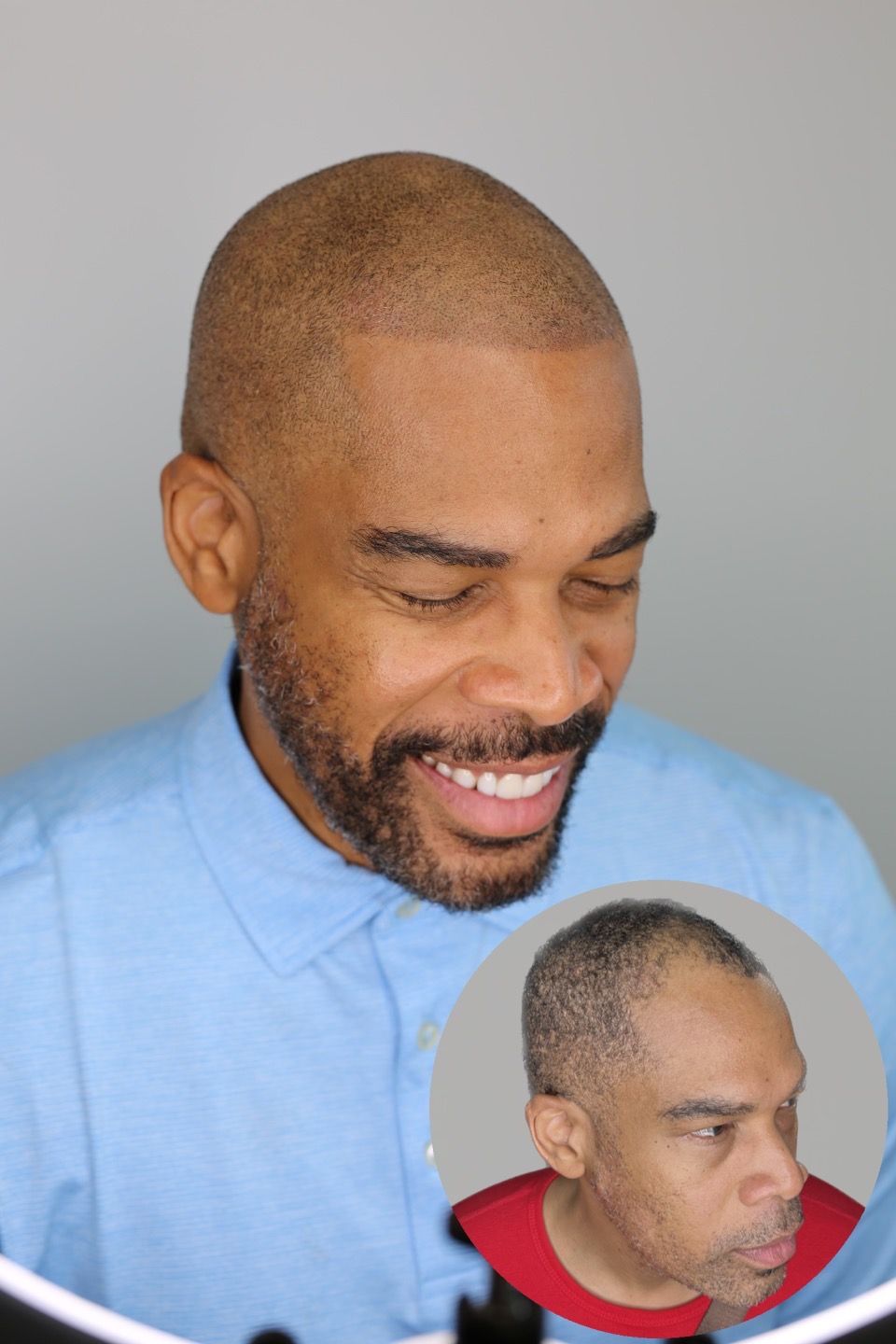 Permanent makeup work by Scalp-Medic in Johns Creek, GA