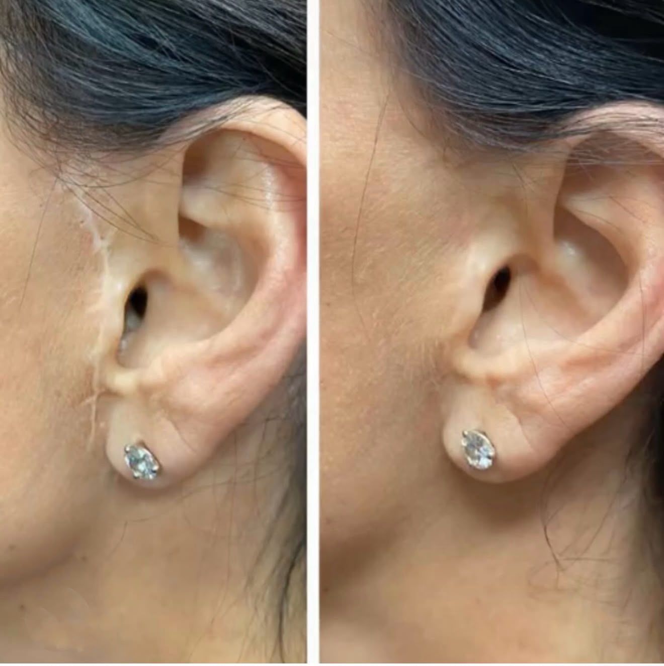 Permanent makeup work by Arch Angels NYC Permanent Make Up Studio in New York, NY