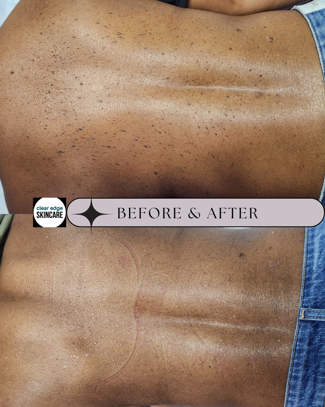Permanent makeup work by Clear Edge Skincare in Johns Creek, GA