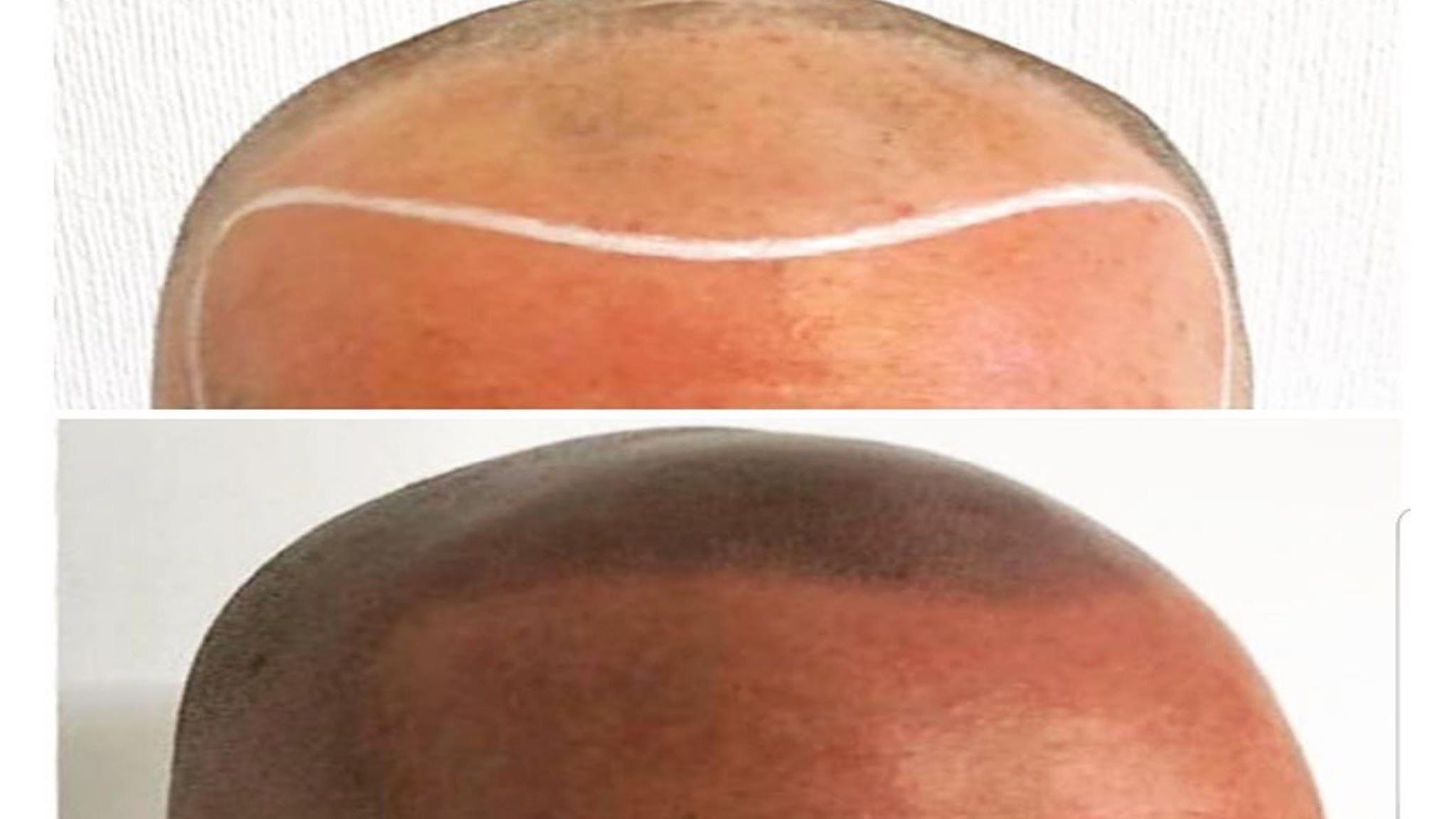 Follicles SMP — permanent makeup work