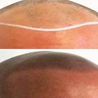 Follicles SMP — permanent makeup work