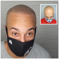 ATL Scalp Micro — permanent makeup work