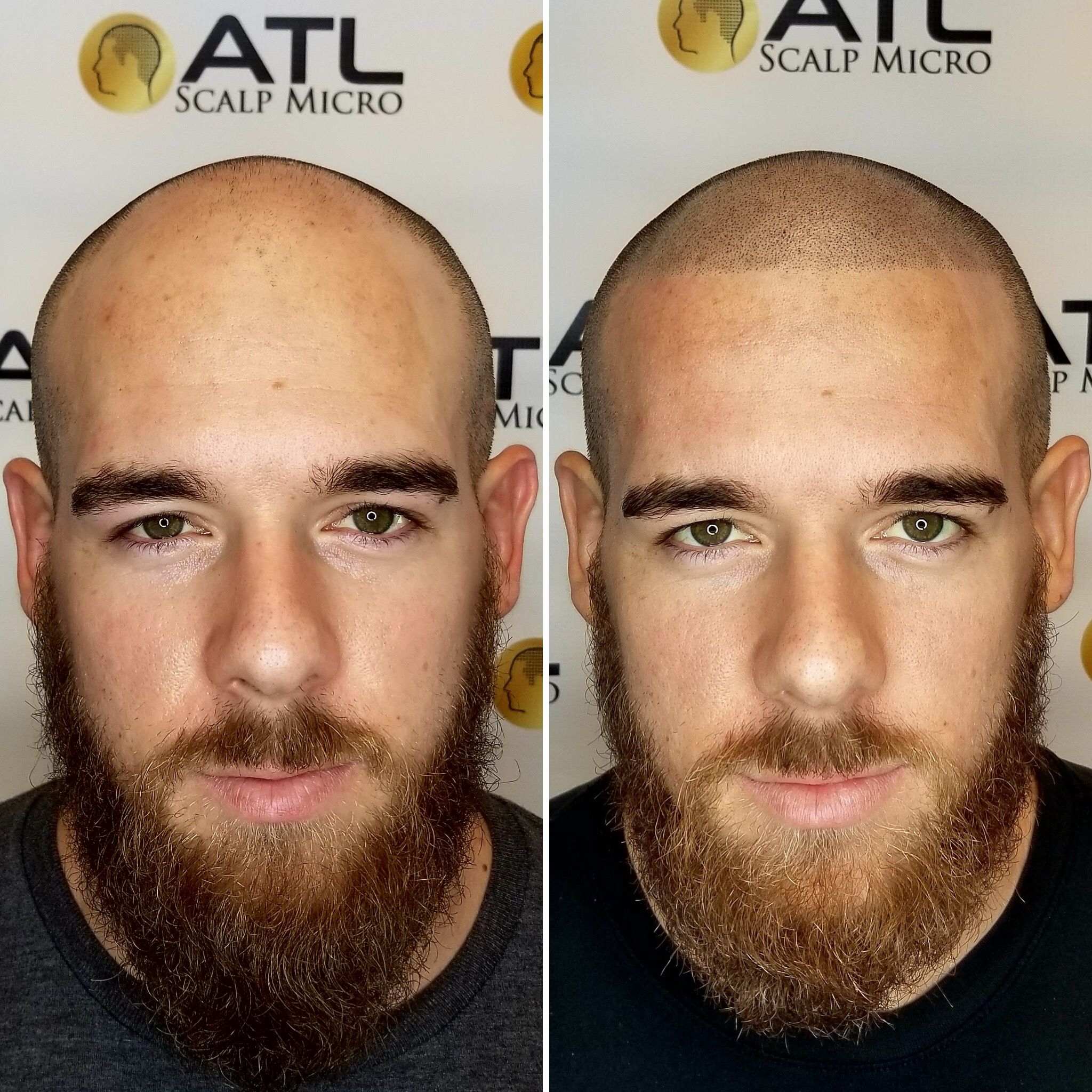 Permanent makeup work by ATL Scalp Micro in Atlanta, GA